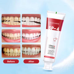 Yayashi SP4 Probiotic Whitening Toothpaste 120g