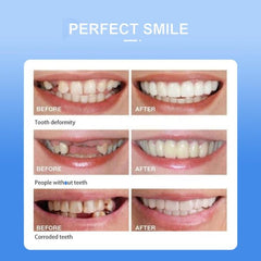 Snap on Smile Instant Confidence with a Brighter